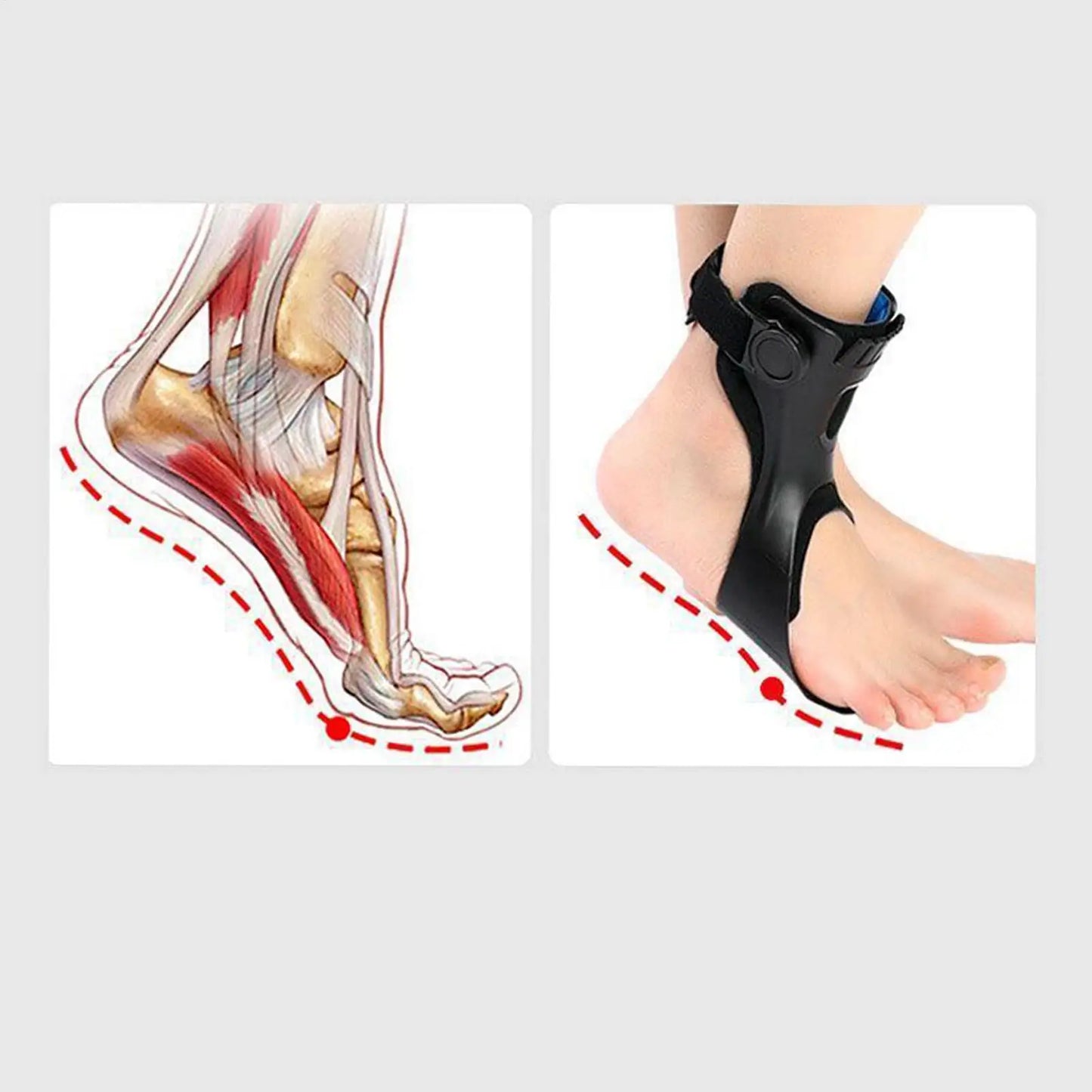 Stride Lift Ankle Support
